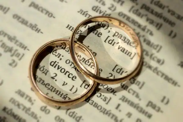 Image of rings removed before divorce mediation Epping